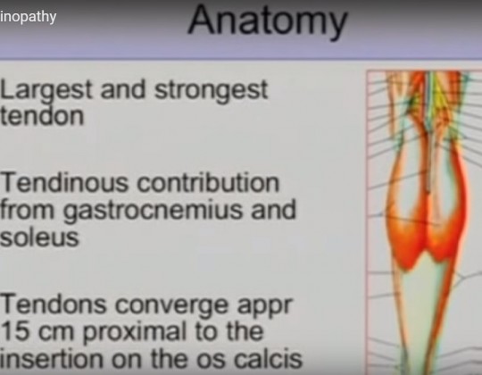 Achilles-tendinopathy