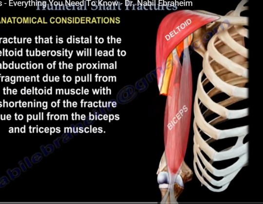 Humeral Shaft #fractures